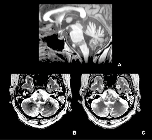 Fig-1